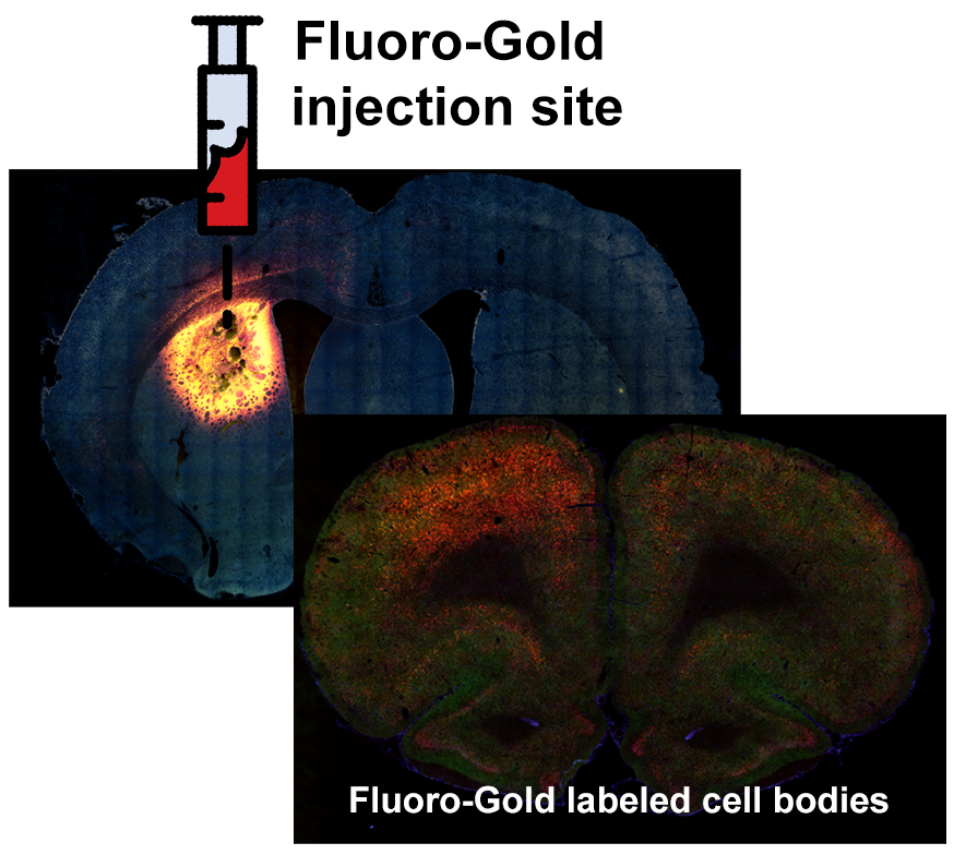 Fluoro-Gold retrograde tracing of prefrontal cortex projections to dorsomedial caudate-putamen