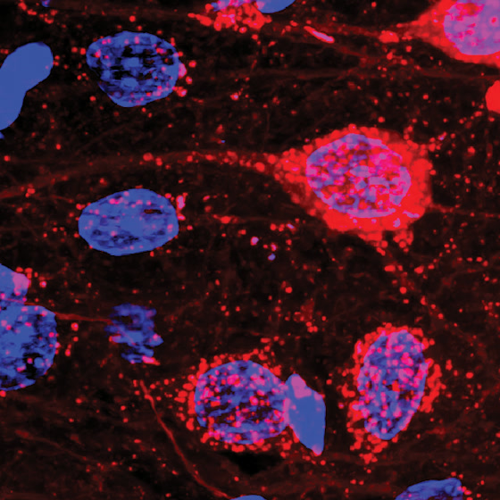 DREADDs-mCherry expressing neurons, 40× magnification